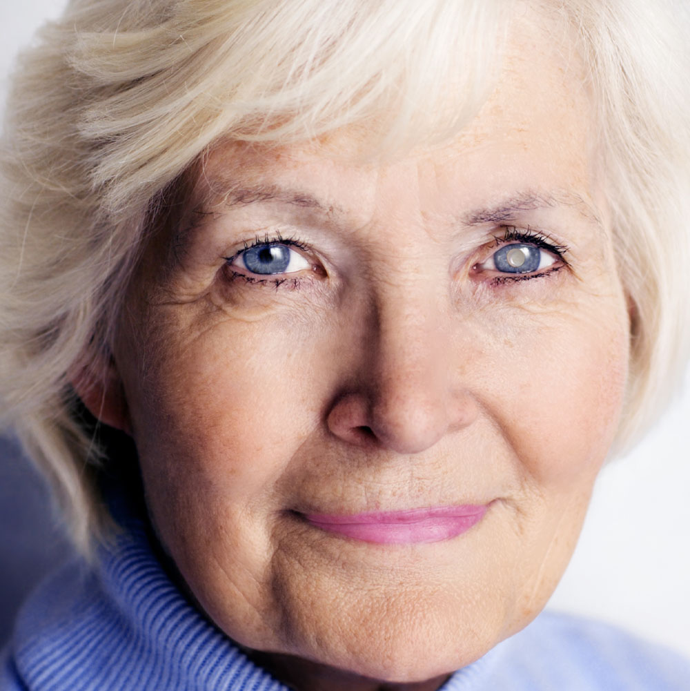 Cataract Surgery Co-Management in Chillicothe