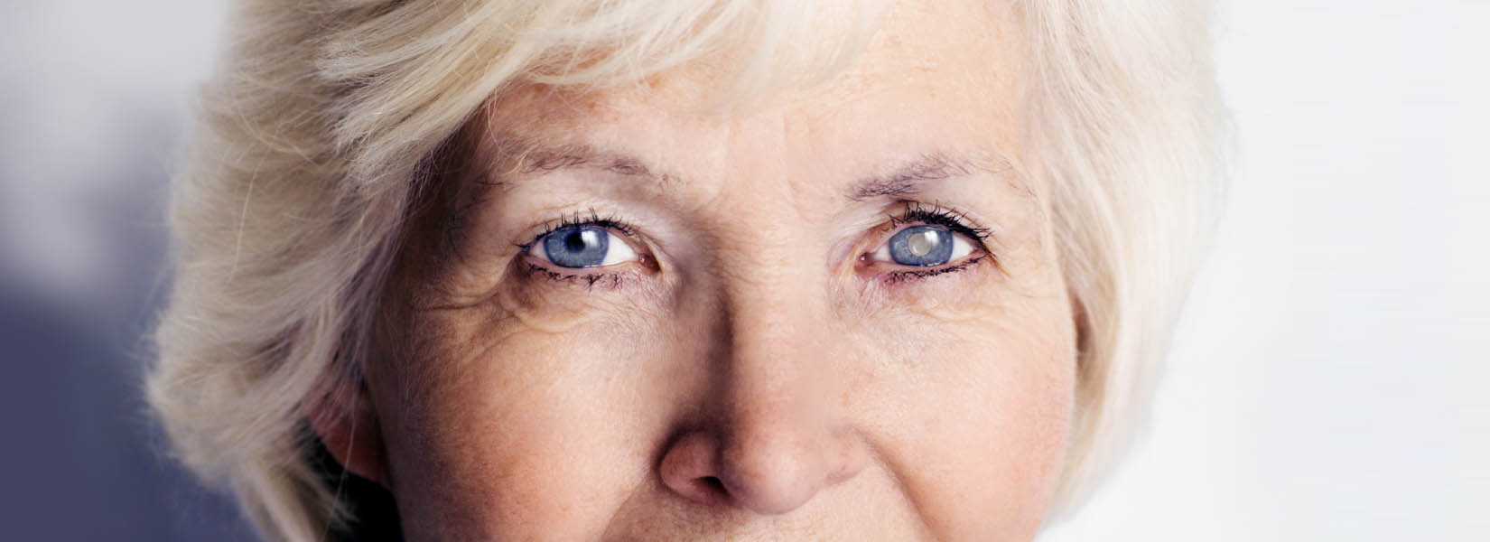 Cataract Surgery in Chillicothe